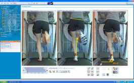 Marathon Physical Therapy: Performance Enhancement